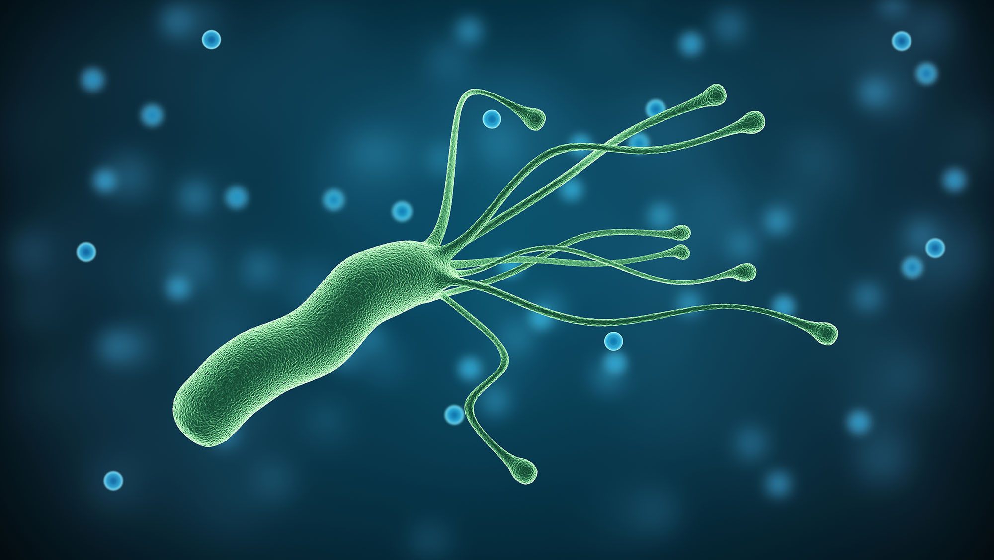 Helicobacter pylori treatment in Dubai