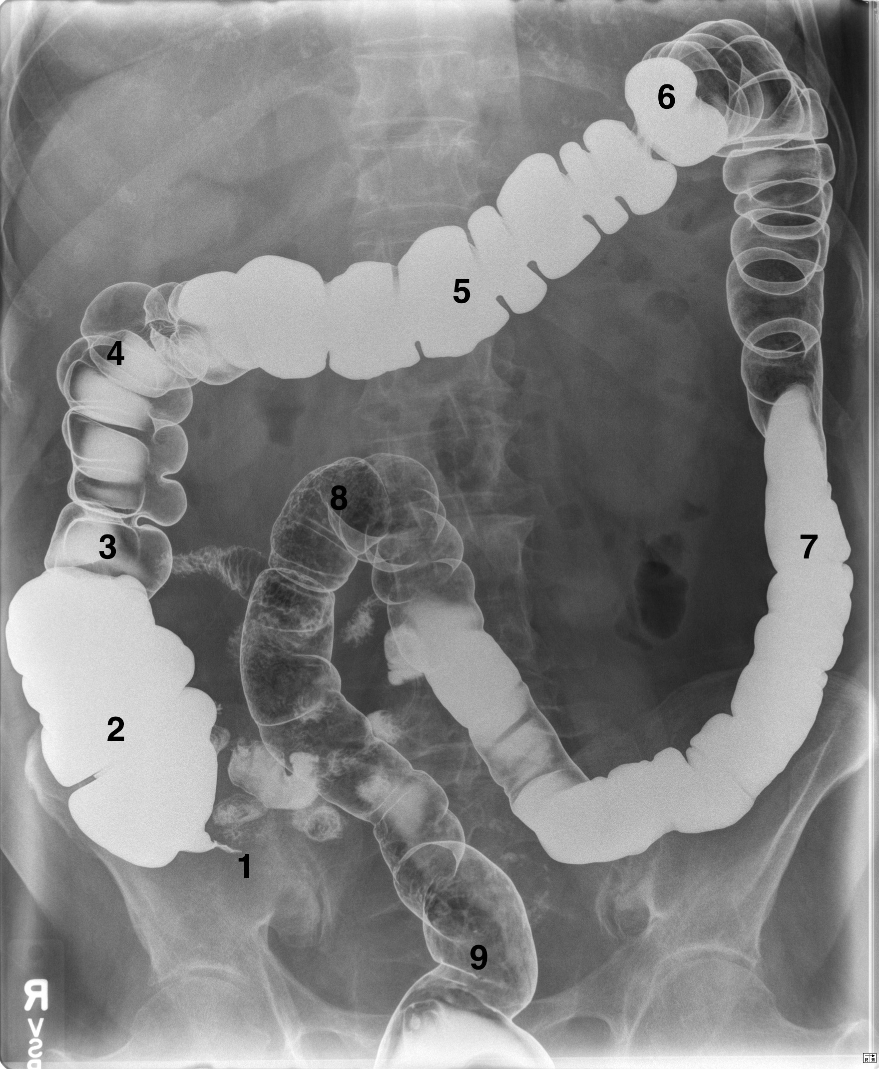 barium swallow test in dubai