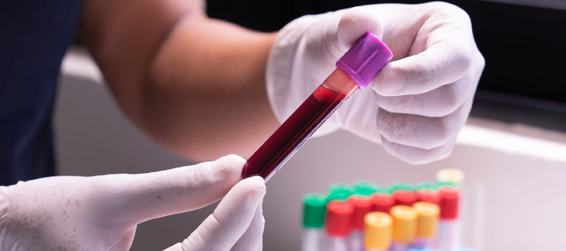 blood test and stool test in dubai