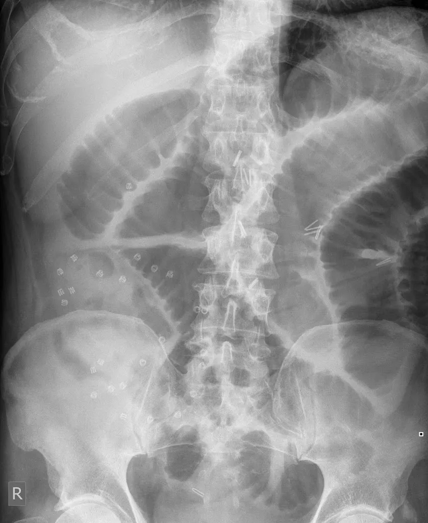 Abdominal X-ray in dubai