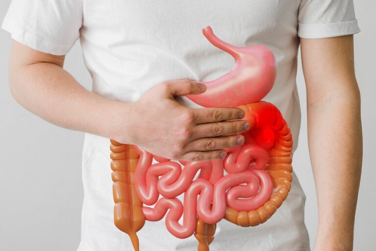 Gut Health Issues