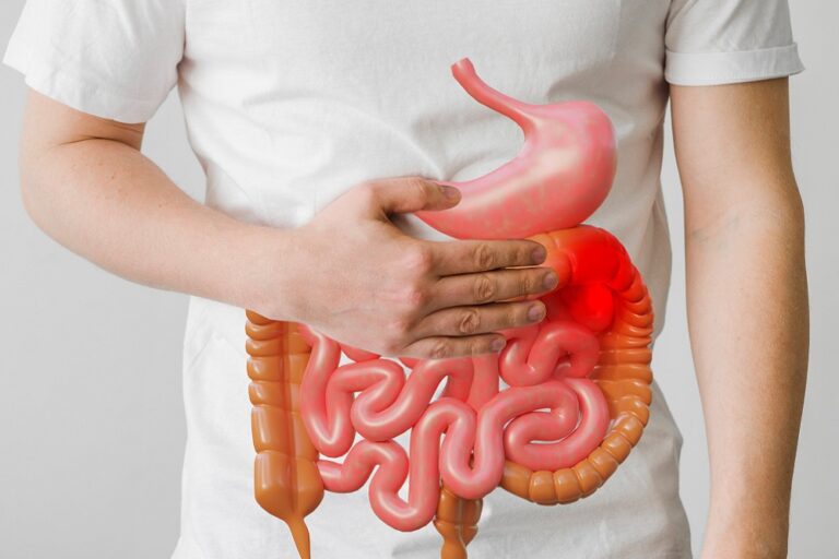 Demystifying Indigestion and Dyspepsia: Your Guide to Symptoms, Treatment, and Prevention