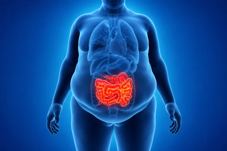 The Link Between Obesity and Digestive System Diseases