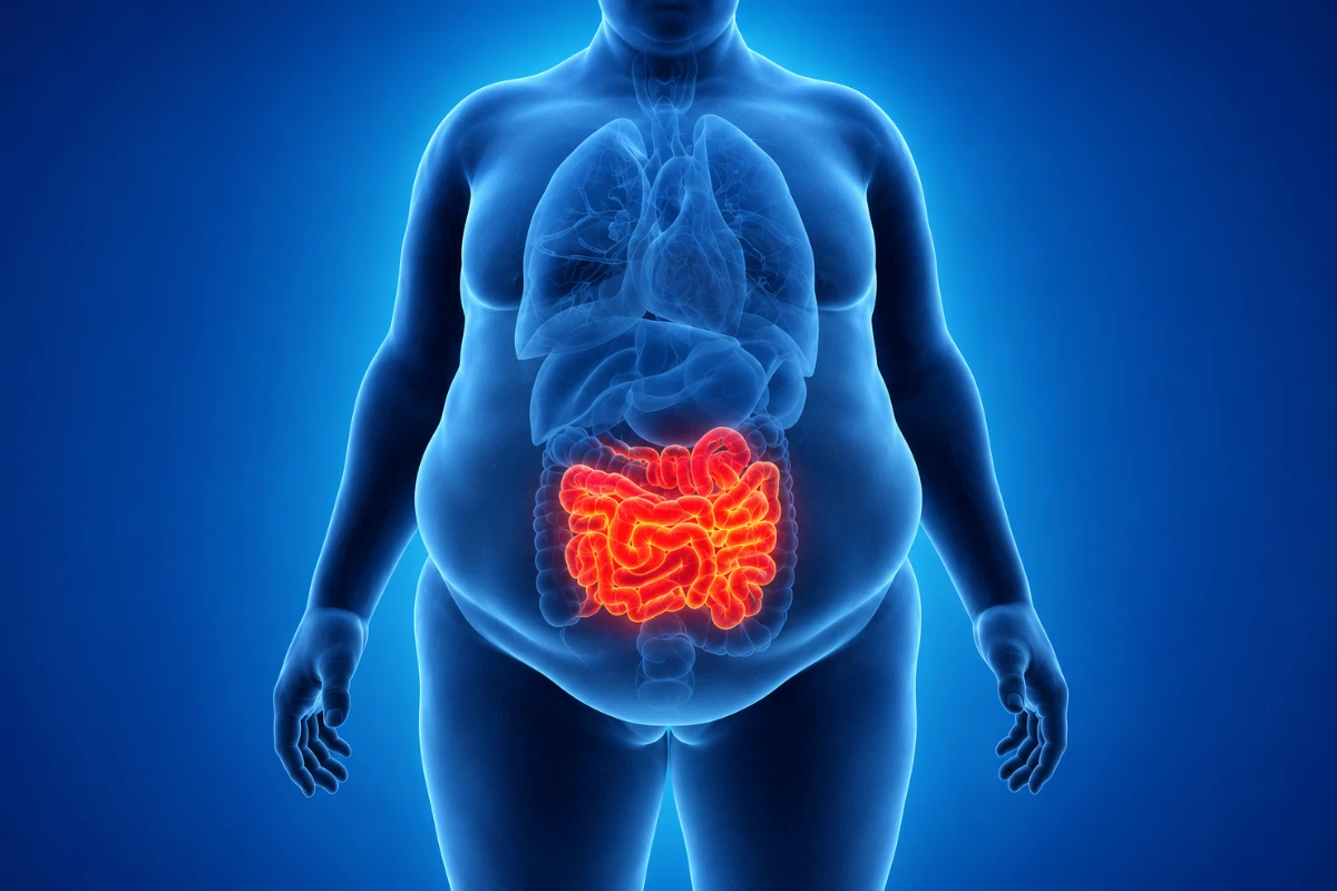 The Link Between Obesity and Digestive System Diseases 1 Medical illustration showing the intestines and digestive system affected by obesity